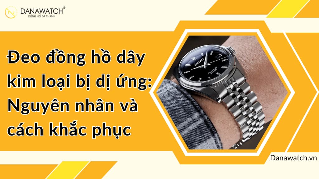 Đeo đồng hồ dây kim loại bị dị ứng: Nguyên nhân và cách khắc phục